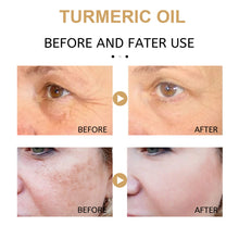 Load image into Gallery viewer, Turmeric Essence Removing Dark Spot Repair Anti-Aging Fading Wrinkle Wrinkle Skin Moisturizing and Nourishing Essence