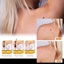 Load image into Gallery viewer, Mole Removal Wart Essence Skin Removal Facial Armpit Flesh Bump Repair Cleaning Care