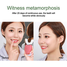 Load image into Gallery viewer, Children Electric Auto Toothbrush U-shaped Brush Teeth Cleaner Tool