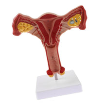 Load image into Gallery viewer, 1:1 Human Female Uterus Ovary Fallopian Tubes Model Anatomical human anatomy model  medical teaching tools
