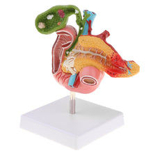 Load image into Gallery viewer, 1:1 Life Size Anatomical Human Pancreas Duodenum Gallbladder Pathology Model, Lab Office Equipment Ornament for Students
