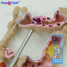 Load image into Gallery viewer, Human Model Simulation Human Colon Anatomy Model Anorectal Intestinal Gastrointestinal Digestive System Teaching Model
