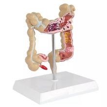 Load image into Gallery viewer, Human Model Simulation Human Colon Anatomy Model Anorectal Intestinal Gastrointestinal Digestive System Teaching Model
