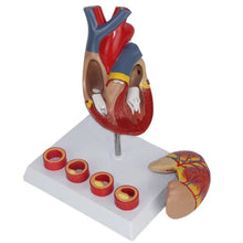 Load image into Gallery viewer, KX-A401 Heart Model 4-Stage Vascular Artery Pathological Stage Cardiac Anatomy Cardiovascular Education Mold
