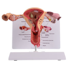 Load image into Gallery viewer, 1Pc Female Reproductive Organs Anatomy Model Uterus Model for
