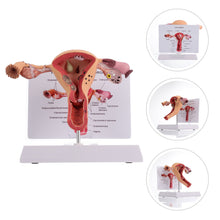 Load image into Gallery viewer, 1Pc Female Reproductive Organs Anatomy Model Uterus Model for
