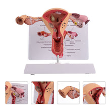 Load image into Gallery viewer, 1Pc Female Reproductive Organs Anatomy Model Uterus Model for
