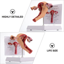 Load image into Gallery viewer, 1Pc Female Reproductive Organs Anatomy Model Uterus Model for
