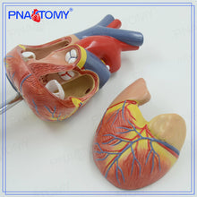 Load image into Gallery viewer, KX-A401 Heart Model 4-Stage Vascular Artery Pathological Stage Cardiac Anatomy Cardiovascular Education Mold
