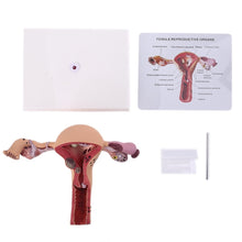 Load image into Gallery viewer, New Human Female Uterus Ovary Disease Dissection Pathology Model Biology Teaching
