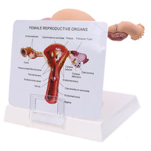 Load image into Gallery viewer, New Human Female Uterus Ovary Disease Dissection Pathology Model Biology Teaching
