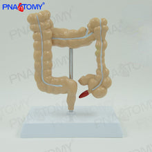 Load image into Gallery viewer, Human Model Simulation Human Colon Anatomy Model Anorectal Intestinal Gastrointestinal Digestive System Teaching Model
