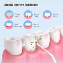 Load image into Gallery viewer, 4 pcs/set Replaceable Oral Dental Nozzles for Oral Irrigator 0ral irrigator
