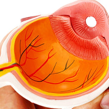 Load image into Gallery viewer, 4X Human Pvc Eye Cataract Anatomy Medical Teaching Model
