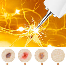 Load image into Gallery viewer, 9 Level LCD Laser Plasma Pen Mole Tattoo Freckle Wart Tag Removal Pen Dark Spot Remover For Face Skin Care Tools Beauty Machine
