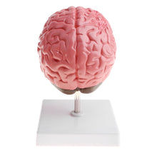 Load image into Gallery viewer, Anatomical Human's Brain Disease Pathological Model Medical Teaching Tool Lab Display Model School Educational Brain Model
