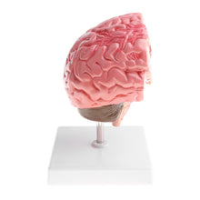 Load image into Gallery viewer, Anatomical Human's Brain Disease Pathological Model Medical Teaching Tool Lab Display Model School Educational Brain Model
