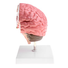 Load image into Gallery viewer, Anatomical Human's Brain Disease Pathological Model Medical Teaching Tool Lab Display Model School Educational Brain Model
