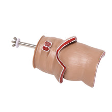 Load image into Gallery viewer, Anatomy Model Human Rectal Hemorrhoid Lesion Model Hemorrhoid Fistula Fistula Fissure Pathology Teaching Model
