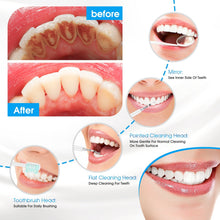 Load image into Gallery viewer, Electric Sonic Dental Irrigator Scaler Tooth Calculus Remover Teeth Whitening Cleaner Remove Tartar Scaler Teeth Cleaning Tool 0ral irrigator
