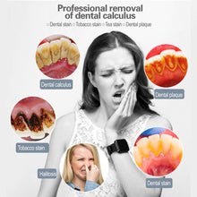 Load image into Gallery viewer, Electric Ultrasonic Dental Calculus Remover Teeth Cleaner Dental Cleaning Teeth Whitening Scaler Dental Tartar Remover Oral Care 0ral irrigator
