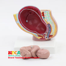 Load image into Gallery viewer, Embryo  pelvic cavity model midwifery teaching  birth control medical  didactical MPT001
