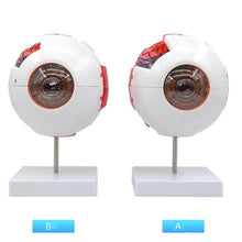 Load image into Gallery viewer, Eyeball Model Anatomical Eyeball Model Medical Learning Aid Teaching Instrument 6X Enlarged Human Eye Anatomical Model
