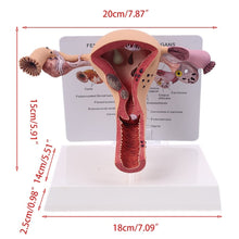 Load image into Gallery viewer, Medical props model Human Female Pathological Uterus Ovary Model Anatomical Disease Pathology Medical Lesion ForBiology Teaching

