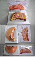 Load image into Gallery viewer, Breast Disease Breast Anatomy Model Human Body Model Anatomical Human Pathological Breast Model Medical Disease &amp; Cancer Anatomy
