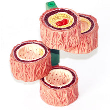 Load image into Gallery viewer, Human Atherosclerosis Model Thrombosis Model Artery Model Thrombosis Evolution Anatomy Medical Teaching Tool
