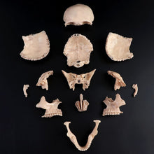 Load image into Gallery viewer, 15pcs/set 4D Disassembled Skull Anatomical Model Detachable Medical Teaching Tool
