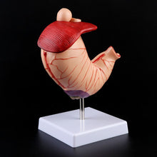 Load image into Gallery viewer, Human Anatomical Anatomy Stomach Model Gastric Pathology Gastritis Ulcer Teaching Learning Tool
