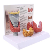Load image into Gallery viewer, Human Anatomical Thyroid Gland Model Pathology Anatomy Digestive System Display Study Teaching Tool Halloween
