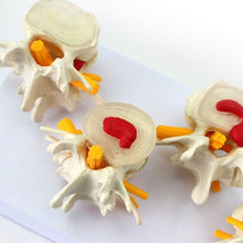 Load image into Gallery viewer, Human Anatomy Skeleton Spine 4-Stages Lumbar Vertebral Model Brain Skull Traumatic Medical Teaching Supplies
