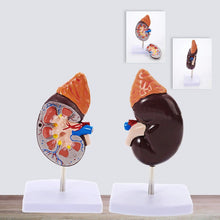 Load image into Gallery viewer, Human Body Organ Viscera Healthy Kidney Anatomy With Adrenal Gland Model Medical Teaching Supplies
