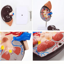 Load image into Gallery viewer, Human Body Organ Viscera Healthy Kidney Anatomy With Adrenal Gland Model Medical Teaching Supplies
