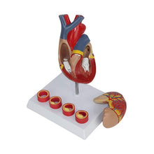 Load image into Gallery viewer, Human Heart Anatomy Model with 4 Stage Thrombus Medical Science Teaching Resources Drop Shipping
