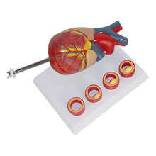 Load image into Gallery viewer, Human Heart Anatomy Model with 4 Stage Thrombus Medical Science Teaching Resources Drop Shipping
