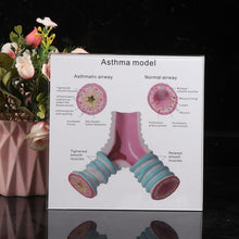 Load image into Gallery viewer, Human Organ Anatomy Model Realistic Bronchus Anatomical Model 4.9'' with Holder
