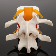Load image into Gallery viewer, Human anatomy skeleton Spine Lumbar Disc Herniation Teaching Model brain skull traumatic pistol school supplies medical instrume
