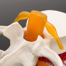 Load image into Gallery viewer, Human anatomy skeleton Spine Lumbar Disc Herniation Teaching Model brain skull traumatic pistol school supplies medical instrume
