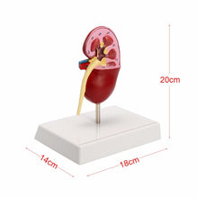 Load image into Gallery viewer, Kidney Pathologies Model Human Body Anatomy Replica of Diseased Kidney for Doctors Office Educational Tool GPI Anatomicals
