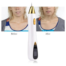 Load image into Gallery viewer, Laser Mole Tattoo Freckle Removal Pen LCD Professional Sweep Spot Wart Corn Dark  Remover 9 Speed Skin Care Salon Beauty Tool

