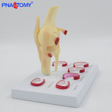 Load image into Gallery viewer, Life Size Knee Joint Model with Ligaments Shows Meniscus Tears Medical Teaching Tool Anatomical Model Skeleton Anatomy Toy
