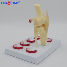 Load image into Gallery viewer, Life Size Knee Joint Model with Ligaments Shows Meniscus Tears Medical Teaching Tool Anatomical Model Skeleton Anatomy Toy
