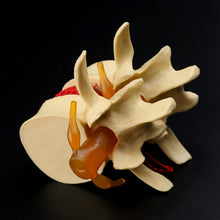 Load image into Gallery viewer, Medical props model Free postage Anatomical Spine Lumbar Disc Herniation Anatomy Medical Teaching Tool
