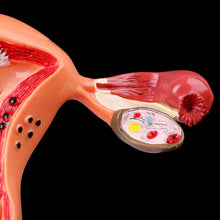 Load image into Gallery viewer, Medical props model Free postage Pathological Uterus Ovary Anatomical Model Anatomy Cross Section Study Tool
