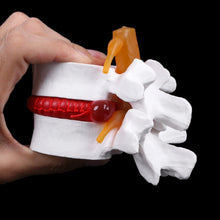 Load image into Gallery viewer, Medical props model Human Anatomical Lumbar Disc Herniation Model Medical Learn Aid Anatomy Instrume
