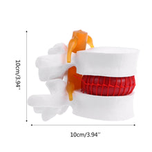 Load image into Gallery viewer, Medical props model Human Anatomical Lumbar Disc Herniation Model Medical Learn Aid Anatomy Instrume
