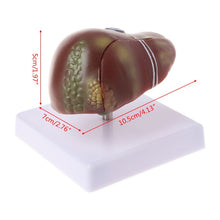 Load image into Gallery viewer, Medical props model Human Liver Pathological Anatomical Model Anatomy School Medical Teaching Display Tool Lab Equipment
